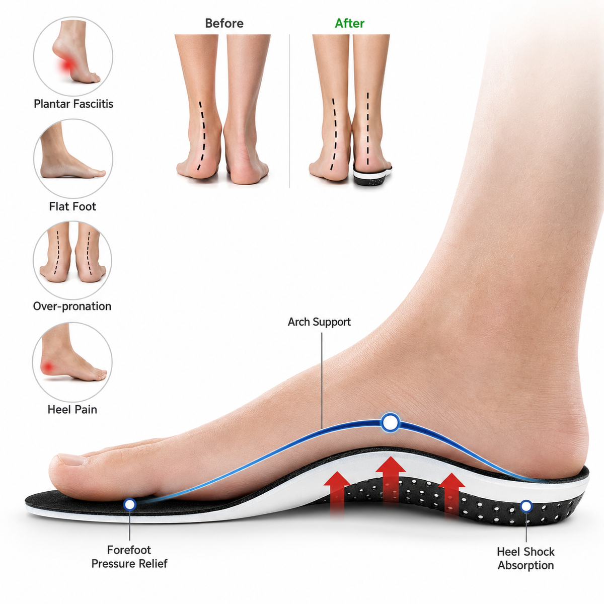 Orthopedic Soles - Instant Pain Relieving and Shock Absorbing